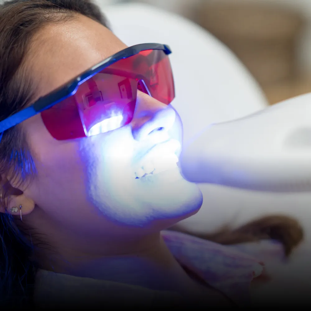 Zoom Whitening