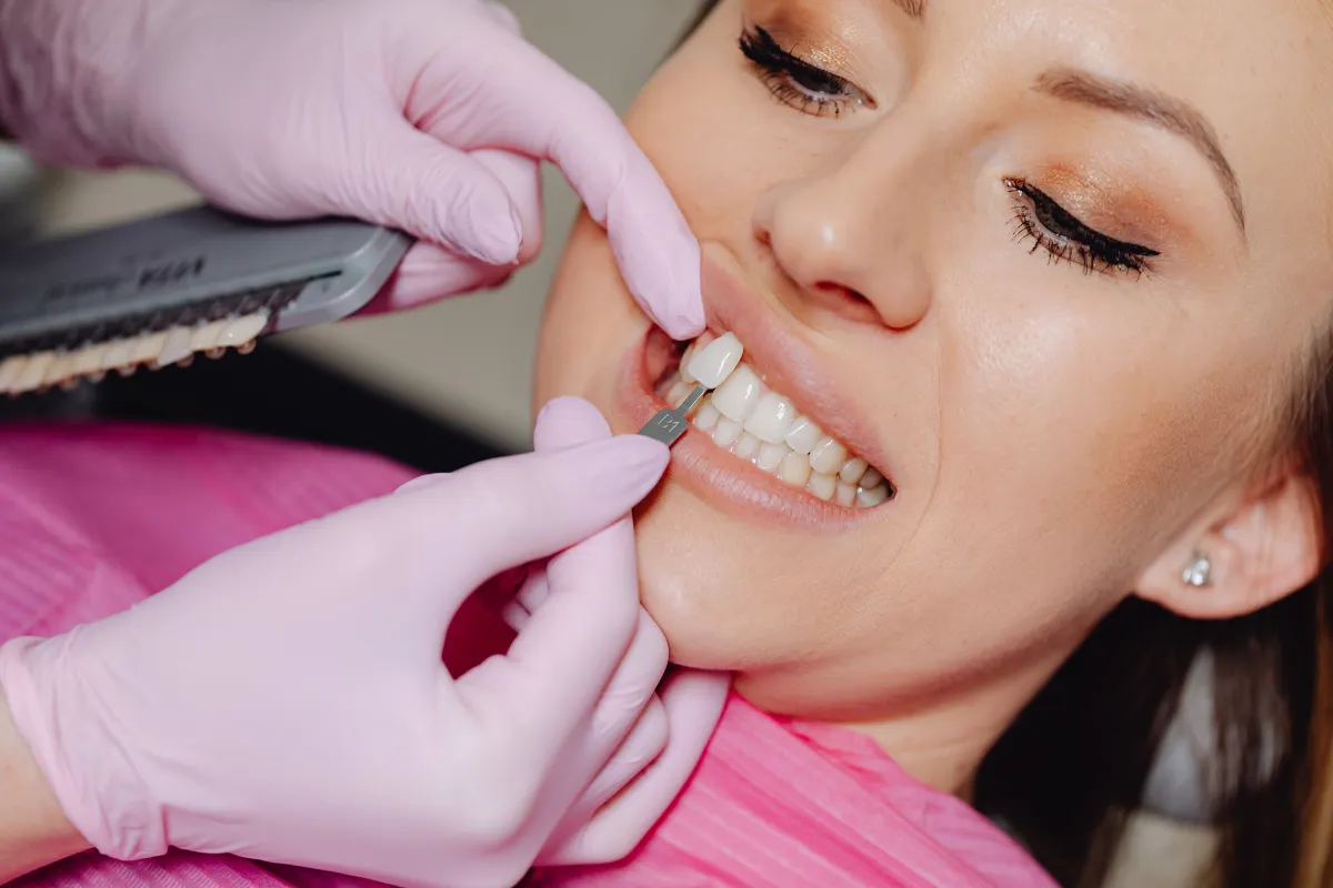 Veneers vs. Crowns: Which is Right for You in Plano?, Plano, TX Dental Crown Placement