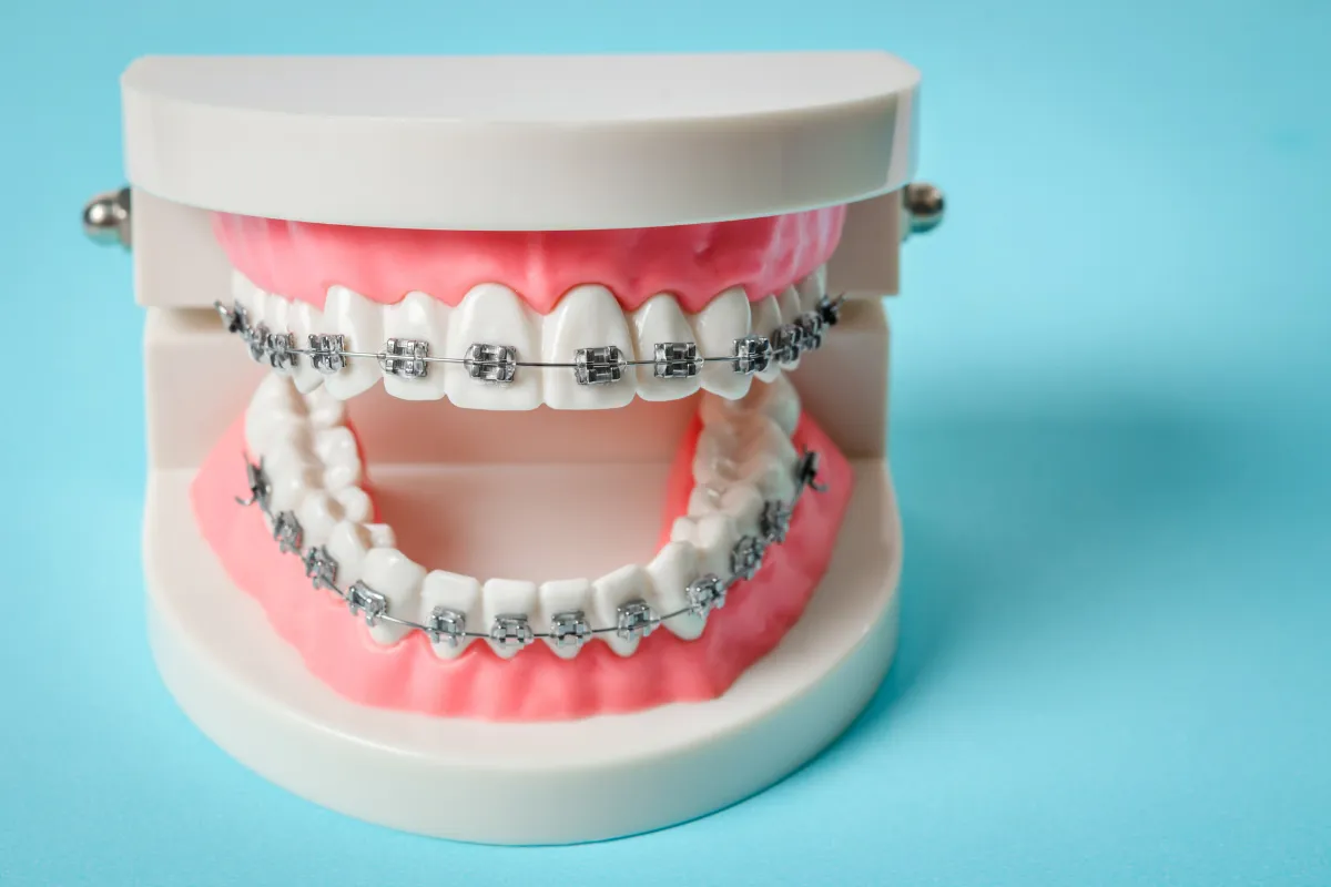Maintaining Your Braces: A Plano Teen's Guide, Plano, TX A selection of interdental brushes, water flosser, and mouthwash.